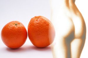 Read more about the article Amit a narancsbőrről tudnod érdemes🍊🤦‍♀️